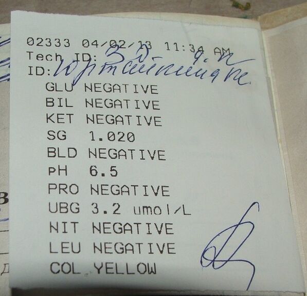 Los resultados de mi análisis de orina antes de femixal